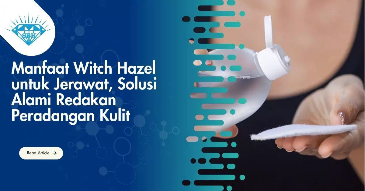 Manfaat Witch Hazel untuk Jerawat, Solusi Alami Redakan Peradangan Kulit